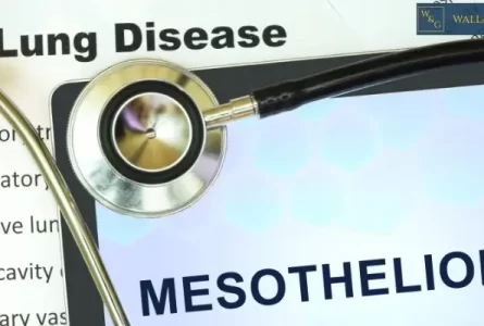 How Long Does It Take to Settle a Mesothelioma Lawsuit In North Carolina? 2024