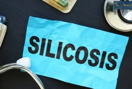 What Are the Symptoms Of Silicosis From Engineered Stone?